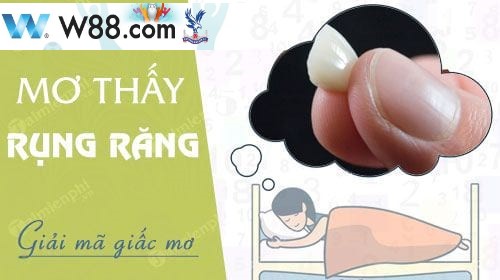 hình 1: Nằm mơ thấy răng rụng - giải mã giấc mơ thấy mình rụng răng